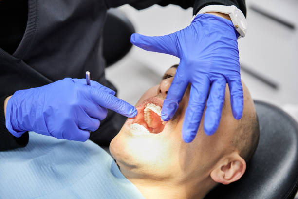 Best Chipped Tooth Repair Near Me  in Saybrook On The Lake, OH