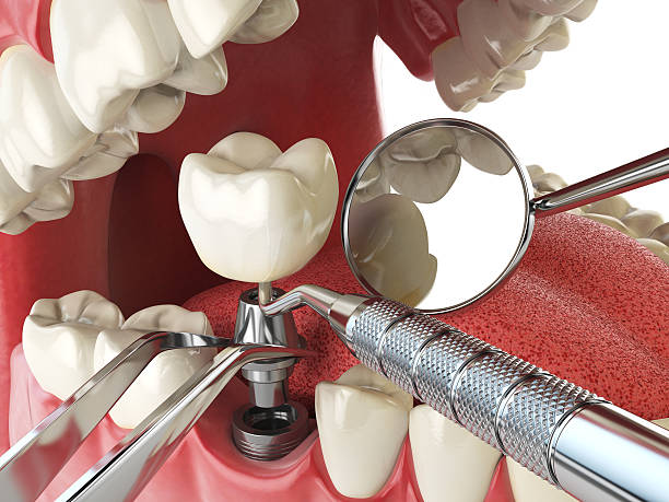 Best Urgent Tooth Repair  in Saybrook On The Lake, OH